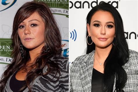 Jersey Shore: All of Angelina Plastic Surgery Procedures